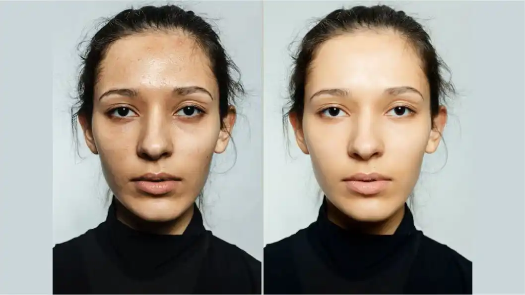 Image Editing Before and After